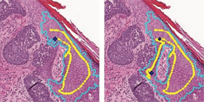 Teaser image for paper TissueWand, a rapid histopathology annotation tool